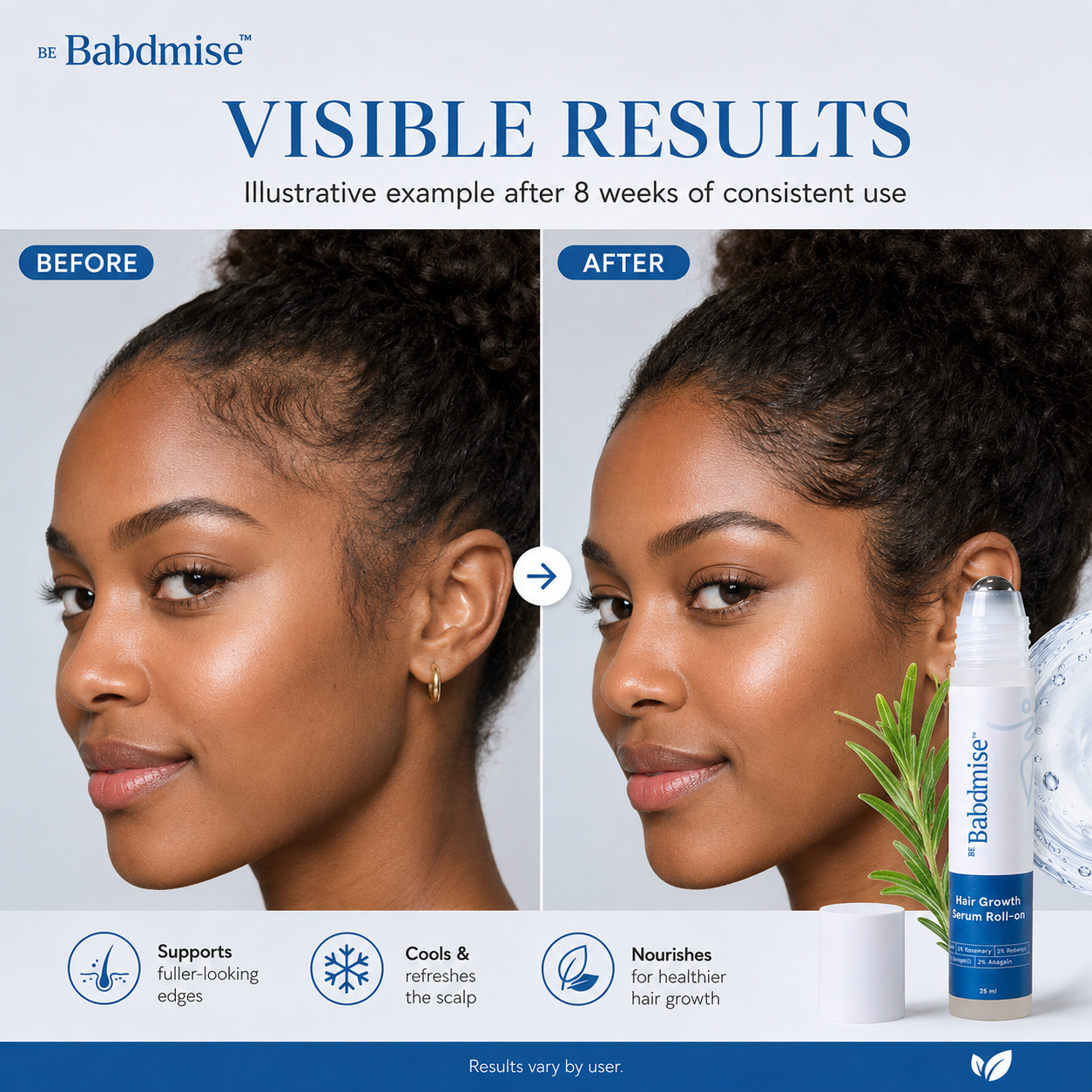 Rosemary Hair Growth Rollerball Serum